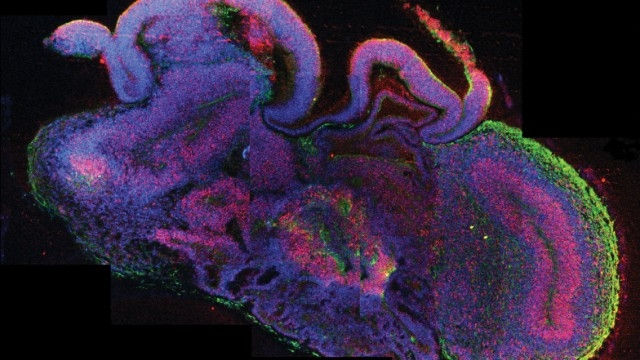 Cerebro1 Descubren un cañón gigante bajo el hielo de Groenlandia