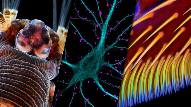 Nikons Small World 2013 Galería: las mejores fotos microscópicas del 2013