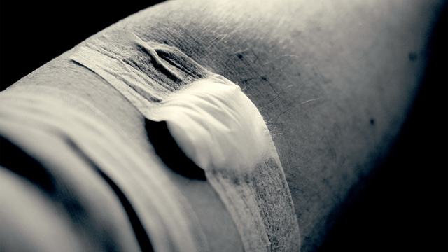 Desarrollan una prueba sanguínea que detecta el cáncer 19 Examen sangre Desarrollan una prueba sanguínea que detecta el cáncer