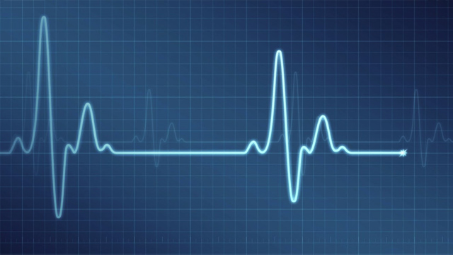 Electrocardiógrafo La Universidad de Guanajuato desarrolla un electrocardiógrafo portátil