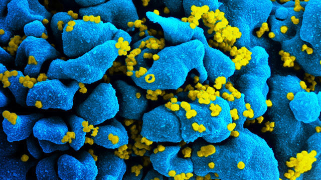 VIH1 Científicos logran eliminar el VIH de células humanas