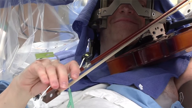 violinista Mira esta increíble cirugía cerebral a un violinista