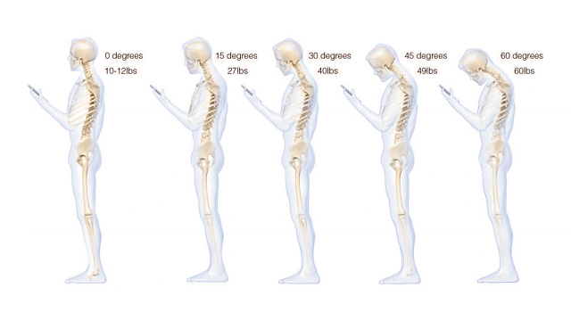 Teléfono columna ¿Cómo dañas a tu columna si te la pasas mirando el teléfono?