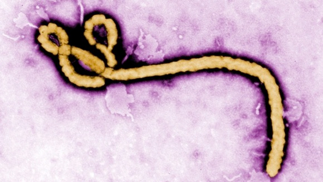 bola1 Aprueban un examen para detectar el virus del Ébola en 15 minutos