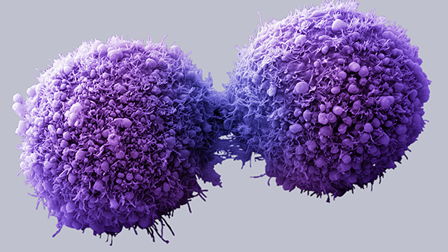 CancerCells Descubren una proteína que vuelve las células cancerosas a la normalidad