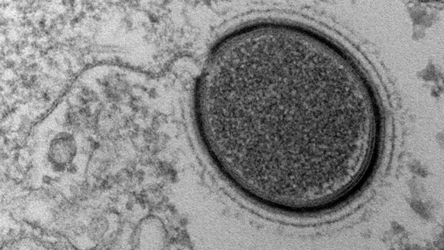 virus Descubren un potencialmente peligroso virus prehistórico en Siberia