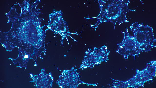 celulas cancerigenas Estados Unidos aprueba el uso de un virus que mata células cancerígenas