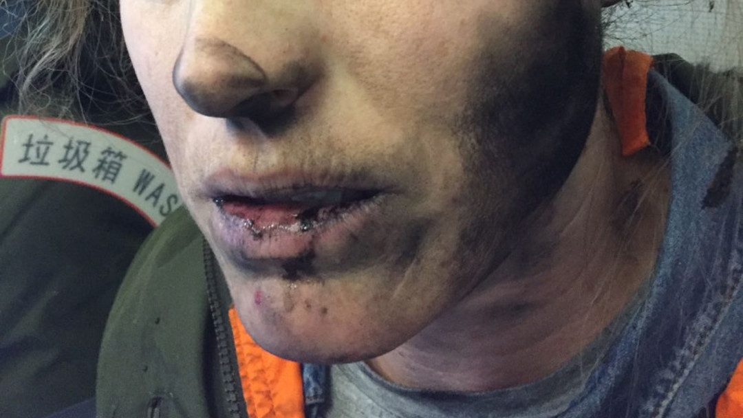 explotan audfonos Primero eran los teléfonos, ahora a una mujer le explotan los audífonos en un vuelo
