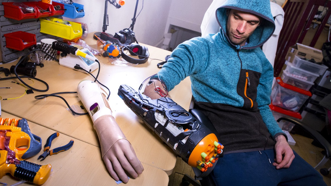 protesis nerf Esta increíble prótesis podría ser la primera arma biónica... de juguete