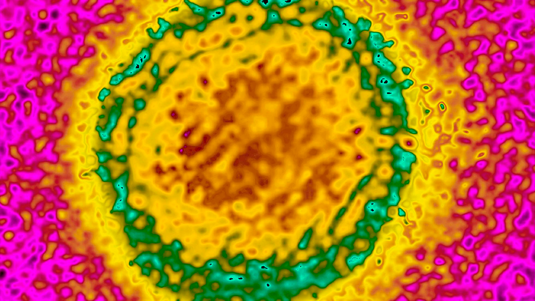 dengue Confirman segundo contagio de dengue por vía sexual en la historia
