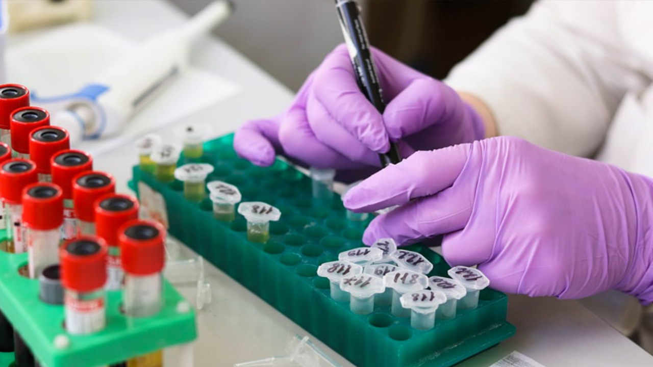 Pruebas de laboratorio