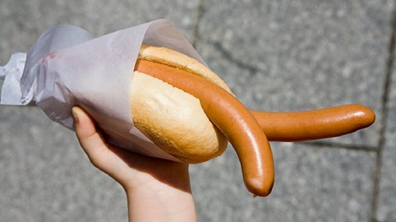 Trifalia Penes Múltiples Penes Supernumerarios Bebé Tres Penes